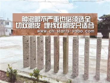 肿泡眼不严重也必须选全切双眼皮 埋线双眼皮只适合眼部基础好的求美者-亚博体育APP下载(图2) 亚博体育在线